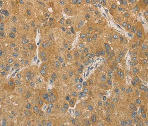 PRPSAP1 Polyclonal Antibody - image 1