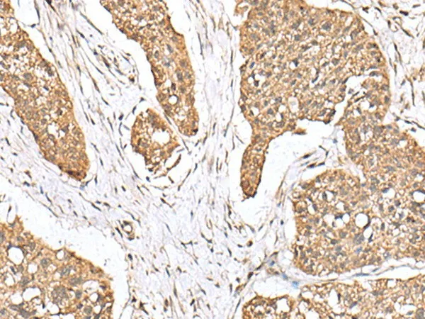 PLA2G2A Polyclonal Antibody - image 1