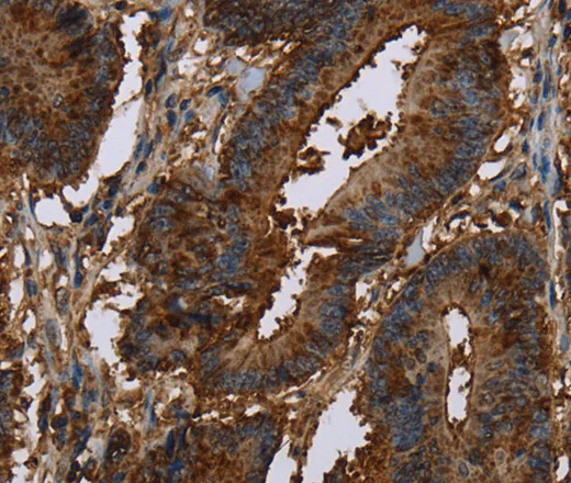 CERS5 Polyclonal Antibody - image 1