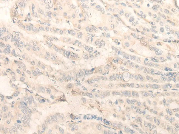 INPP1 Polyclonal Antibody - image 1