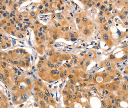AIM2 Polyclonal Antibody - image 1
