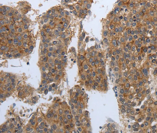 PDIA2 Polyclonal Antibody - image 1