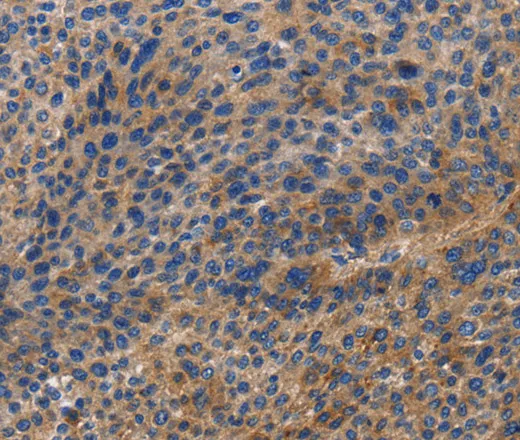 DOK4 Polyclonal Antibody - image 1