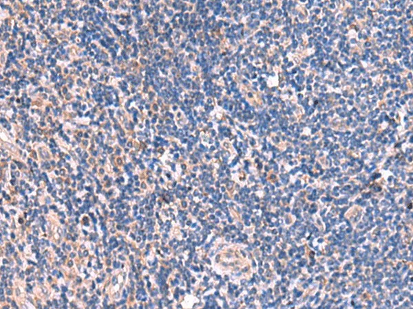 MPP1 Polyclonal Antibody - image 1