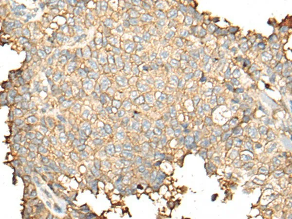 CD55 Polyclonal Antibody - image 1