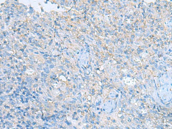 HRAS Polyclonal Antibody - image 1