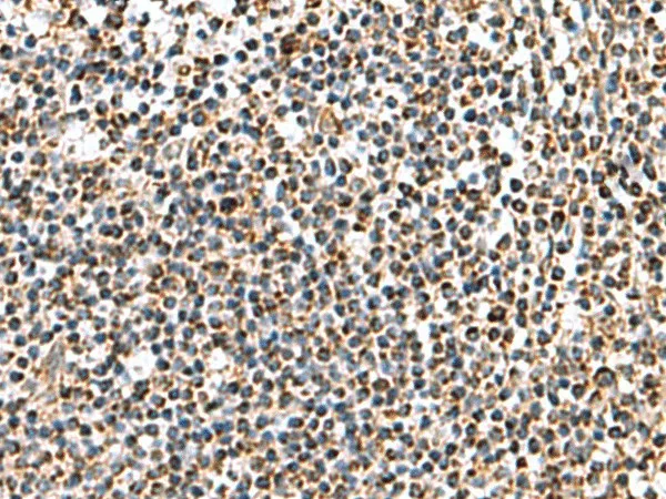 AP1S3 Polyclonal Antibody - image 1