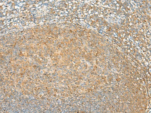 GRHPR Polyclonal Antibody - image 1