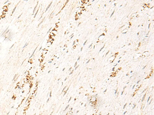 MDFI Polyclonal Antibody - image 1