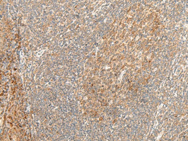 GPR62 Polyclonal Antibody - image 1