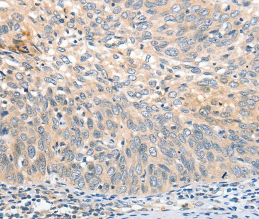 APTX Polyclonal Antibody - image 1