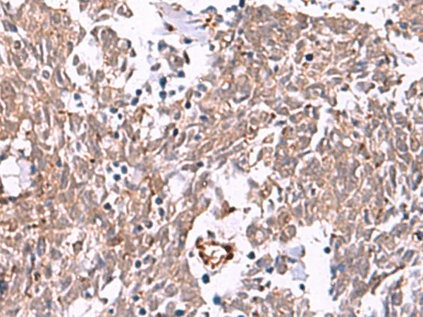 IRX2 Polyclonal Antibody - image 1
