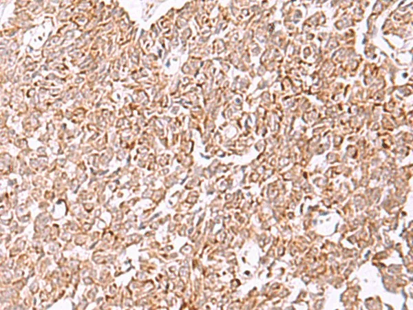 IRX2 Polyclonal Antibody - image 2