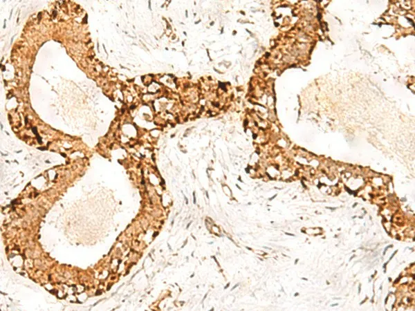 POLH Polyclonal Antibody - image 1