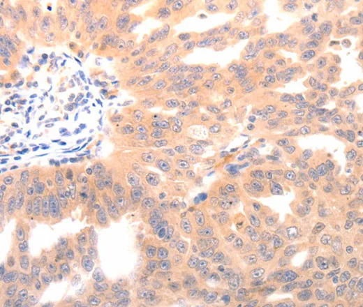 BGLAP Polyclonal Antibody - image 1
