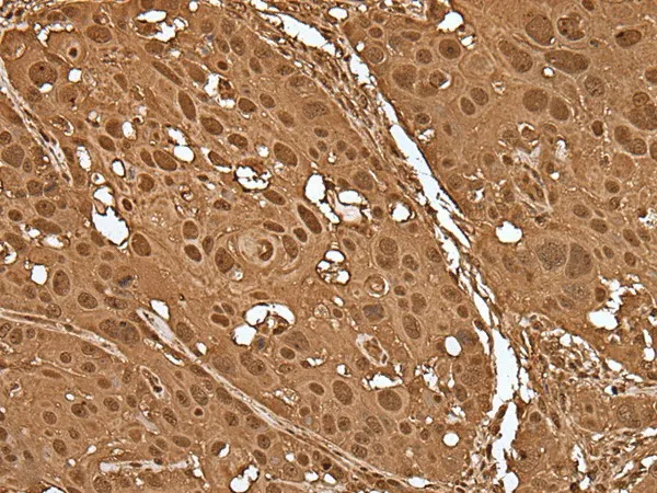 VCP Polyclonal Antibody - image 1