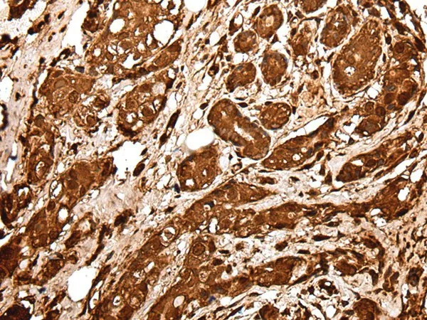 VCP Polyclonal Antibody - image 2