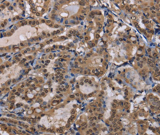 CUL3 Polyclonal Antibody - image 1