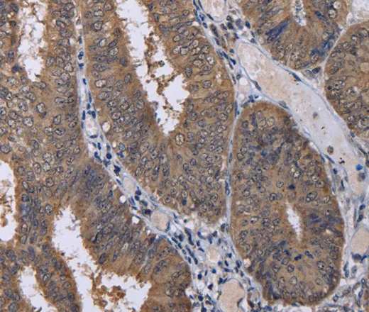 CUL3 Polyclonal Antibody - image 2