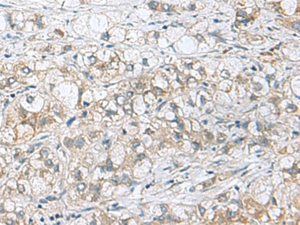 PHPT1 Polyclonal Antibody - image 1