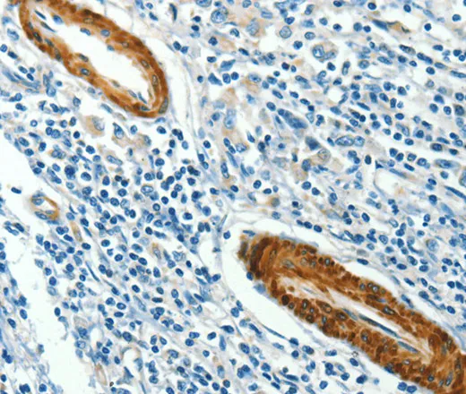 CAV3 Polyclonal Antibody - image 1