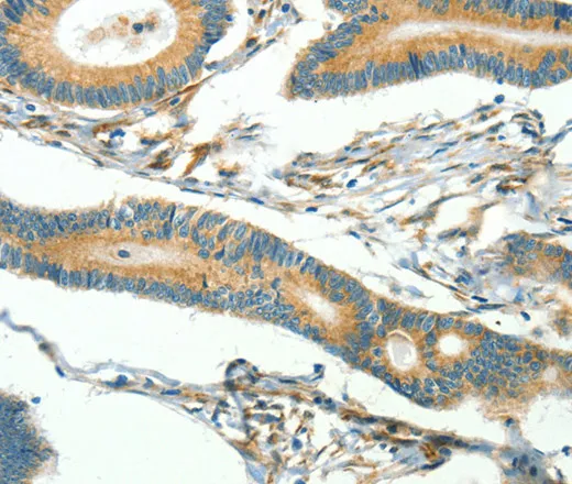 CAV3 Polyclonal Antibody - image 2