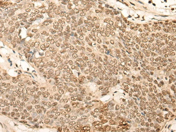 EIF4A3 Polyclonal Antibody - image 1