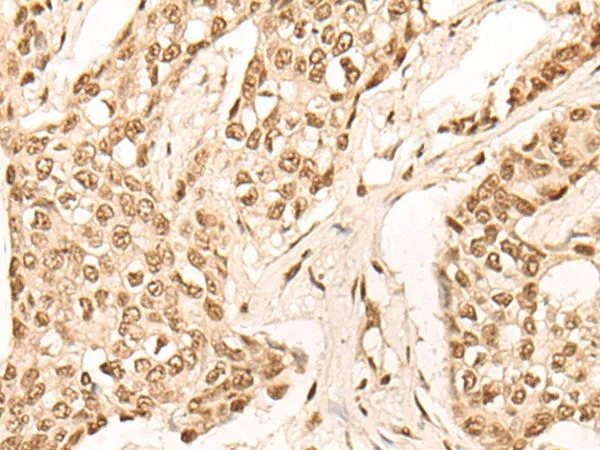 EIF4A3 Polyclonal Antibody - image 2
