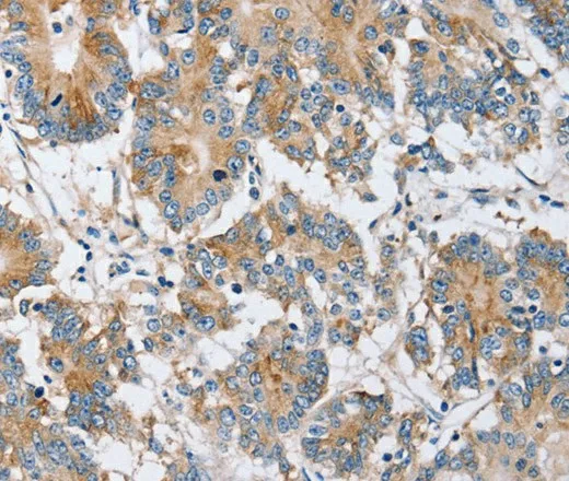 PPM1F Polyclonal Antibody - image 2