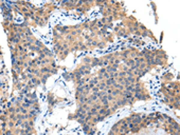 PPBP Polyclonal Antibody - image 1