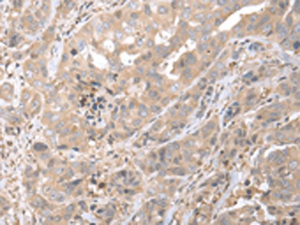 PPBP Polyclonal Antibody - image 2