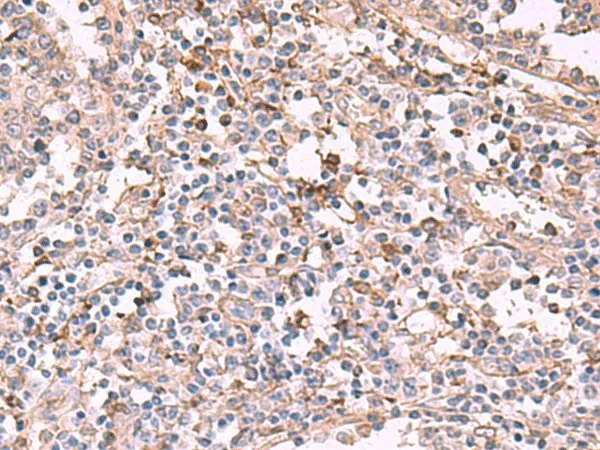 ADH1B Polyclonal Antibody - image 1
