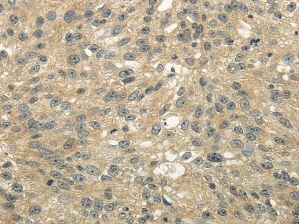 UGT2B4 Polyclonal Antibody - image 1