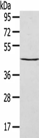 SEPT2 Polyclonal Antibody - image 1