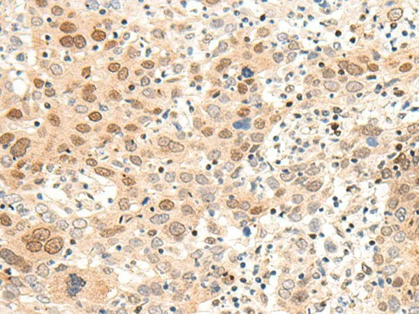 ARMC8 Polyclonal Antibody - image 1