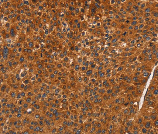 CDK19 Polyclonal Antibody - image 1