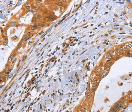 CDK19 Polyclonal Antibody - image 2