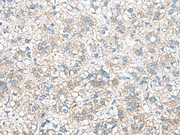 RAB13 Polyclonal Antibody - image 1