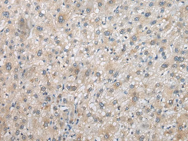 PSMF1 Polyclonal Antibody - image 1