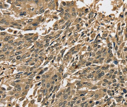 PPP1CC Polyclonal Antibody - image 1