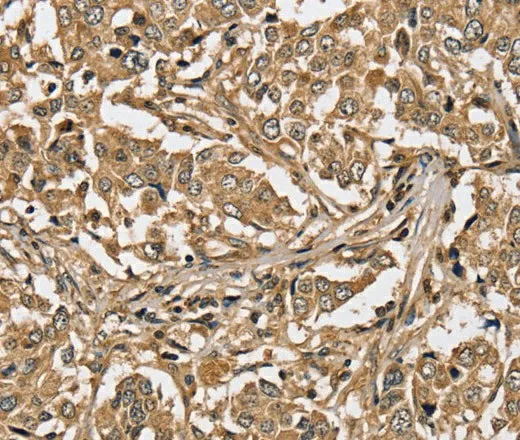 PPP1CC Polyclonal Antibody - image 2
