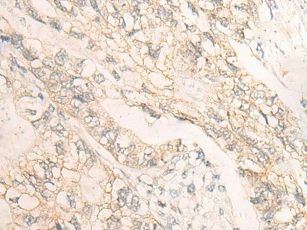 DMTN Polyclonal Antibody - image 1
