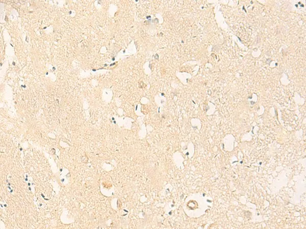 IL37 Polyclonal Antibody - image 1