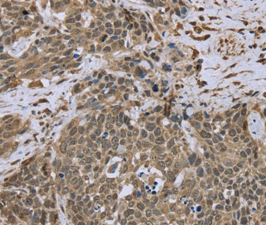 DCTN4 Polyclonal Antibody - image 1