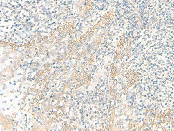 PSCA Polyclonal Antibody - image 1