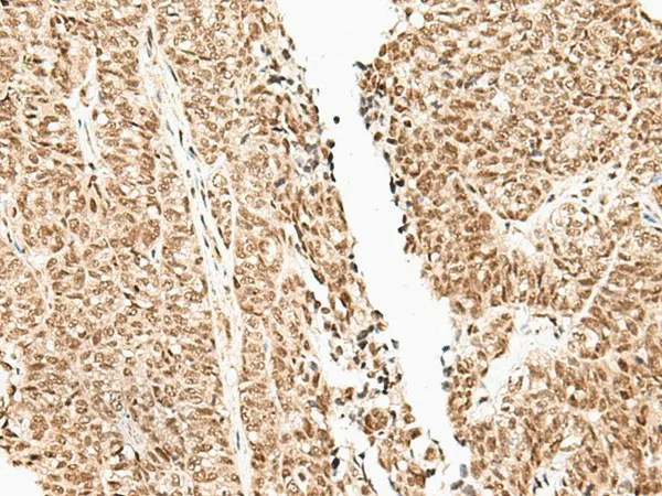 FUT3 Polyclonal Antibody - image 1