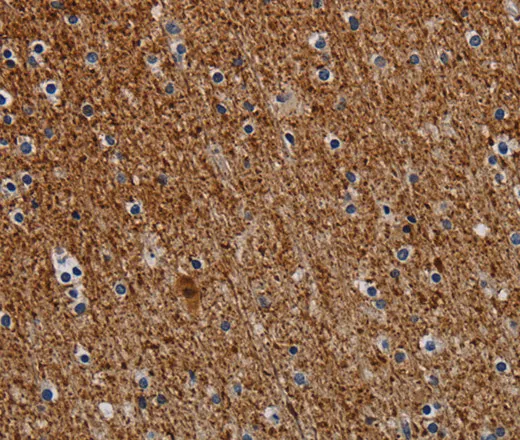 DCAF6 Polyclonal Antibody - image 1