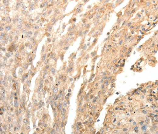 SFTPD Polyclonal Antibody - image 1