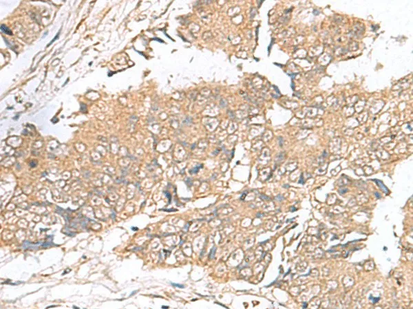 ARF5 Polyclonal Antibody - image 1