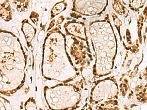 LRRC2 Polyclonal Antibody - image 1